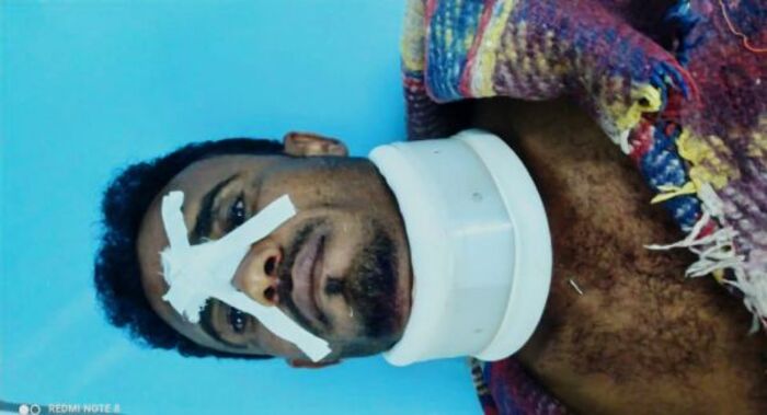 #الحديدة.. إصابة مدني بانفجار لغم حوثي زُرع داخل منزله