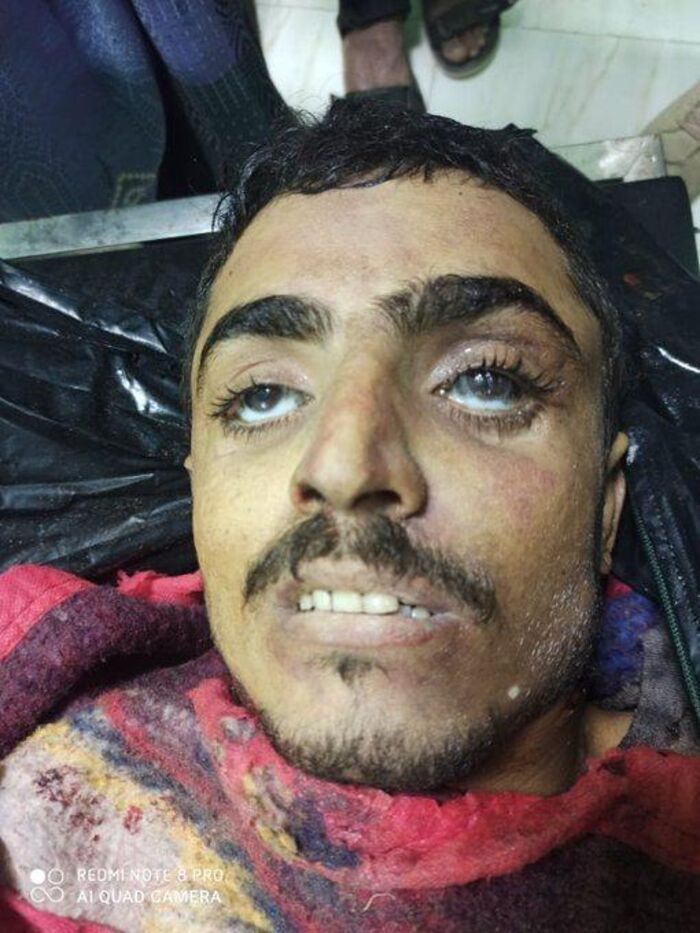 صورة | مصرع القيادي عبدالوهاب بدر الدين بنيران المشتركة في الحديدة