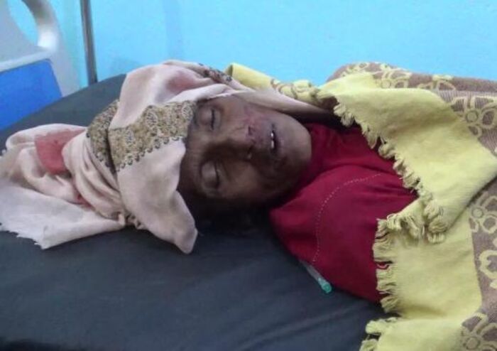 الحديدة | استشهاد امرأة بالشعينة برصاص قناص حوثي "صورة"