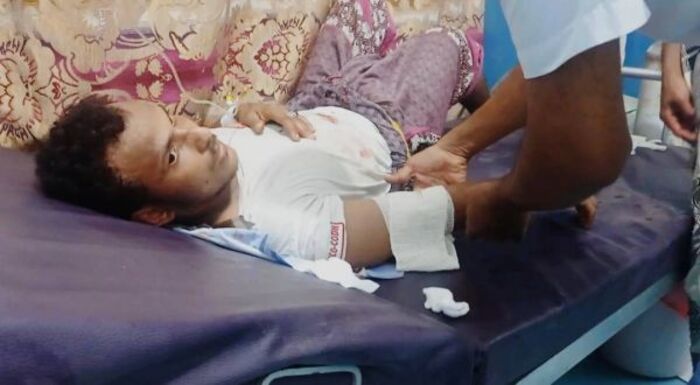 الحديدة.. إصابة مدني برصاص مسلح حوثي في حيس أمام منزله