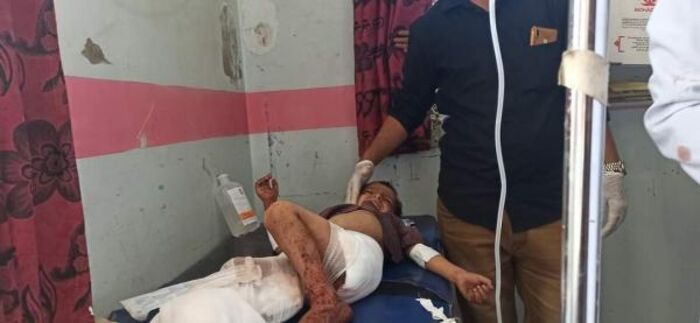 مجزرة حوثية جديدة في تعز بين ضحاياها اطفال
