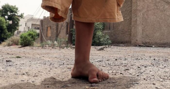 مقتل وإصابة 14 مدنيا بالألغام في خمس محافظات يمنية خلال 28 ساعة