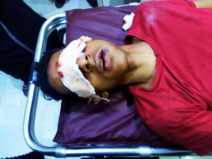 مقتل شابين برصاص قوات امنية فرّقت متظاهرين غاضبين في #حضرموت