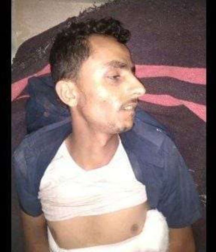 مقتل سائق شاحنة نقل ثقيل في لحج
