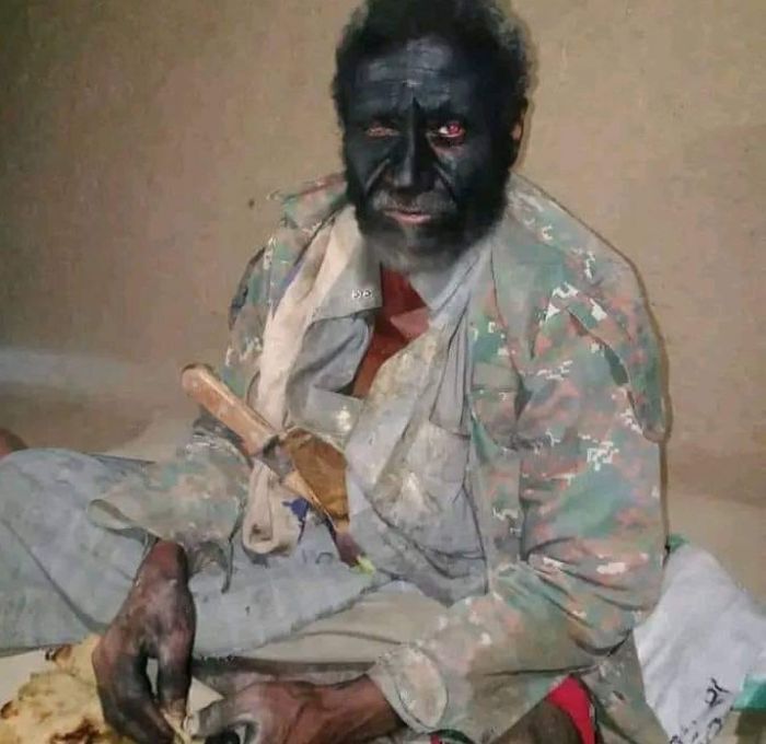 الجوف.. مقتل مختل عقلياً برصاص مسلح حوثي في الزاهر