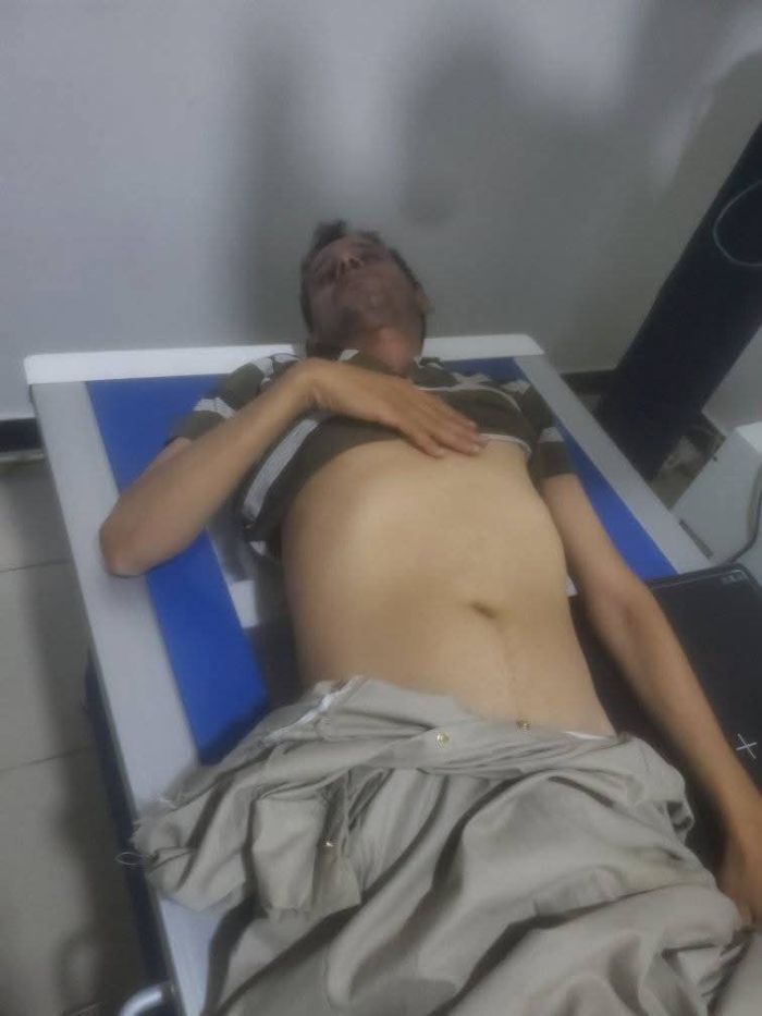 محاولة اغتيال تثير الجدل.. ناشط حوثي يُضرب بوحشية في صنعاء بعد فضحه فساد "الأوقاف"