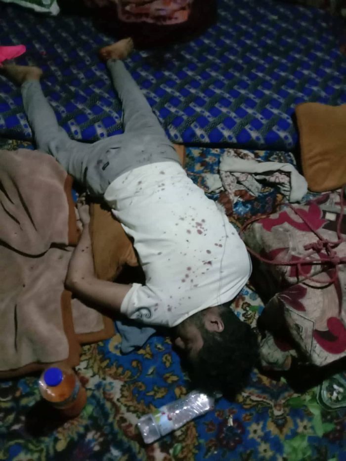 تفاصيل حادثة طعن وقتل تثير الرعب في إب