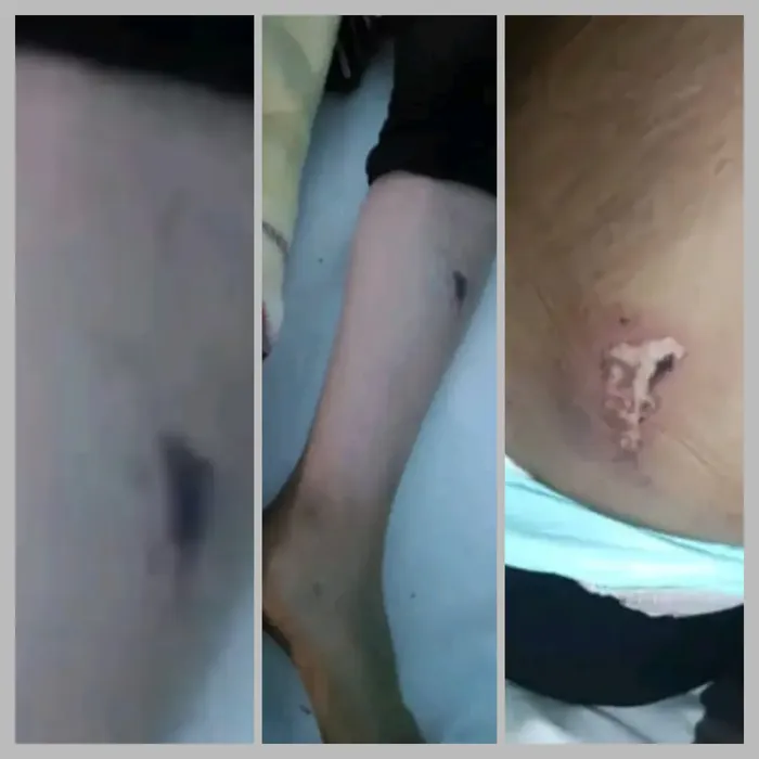 تعز.. العثور على طفلة في شرعب بعد يومين من اختفائها في ظروف غامضة