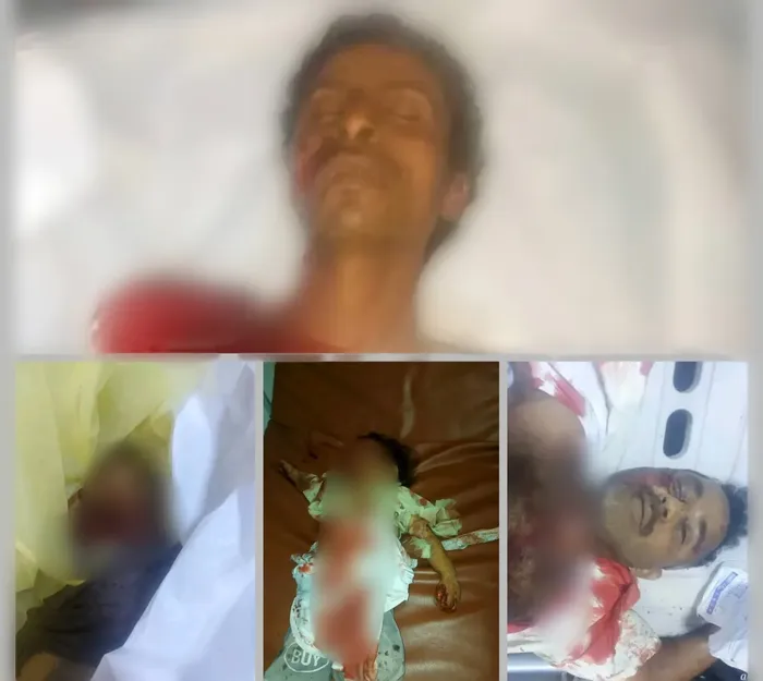 وزارة حقوق الإنسان: استهداف تجمع مدني في حيران حجة جريمة حوثية متعمدة