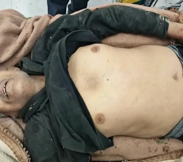 استشهاد مدني مسن برصاص قناص حوثي في حي الزهراء شرقي تعز