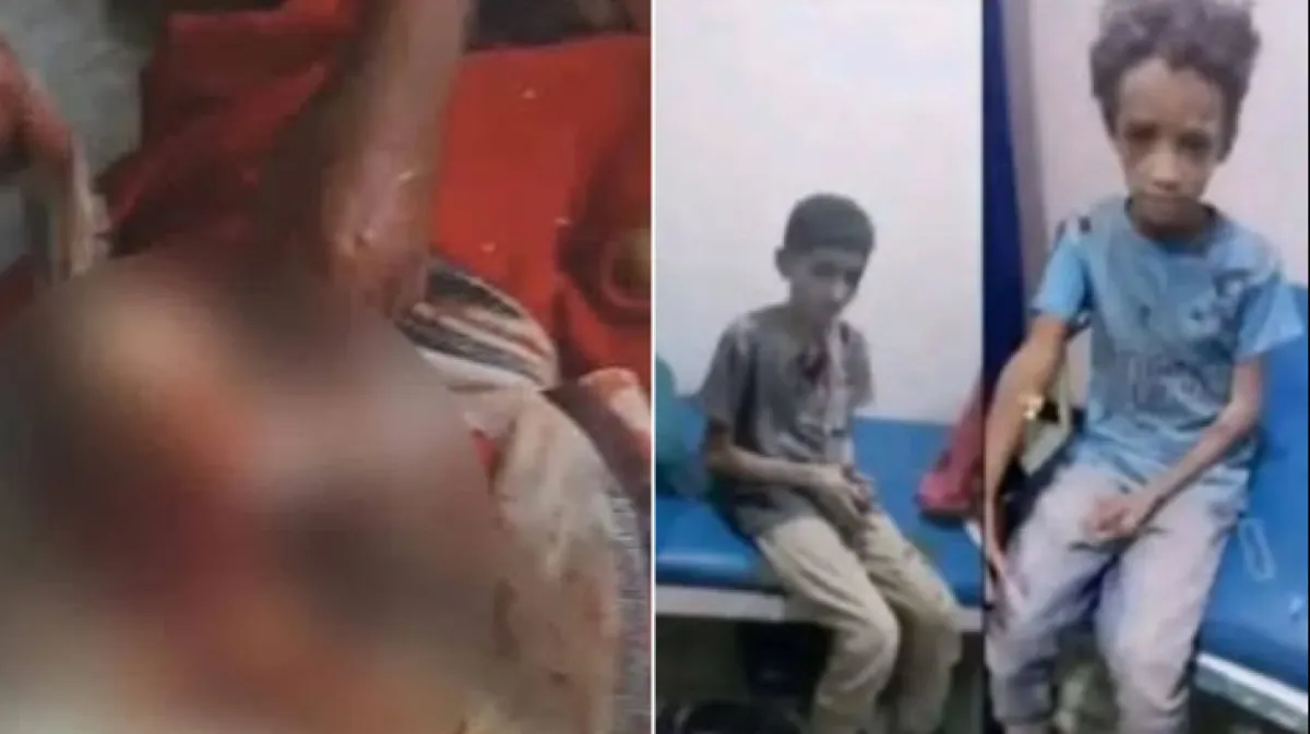 مقتل 6 مدنيين وإصابة 17 آخرين في قصف حوثي على تعز