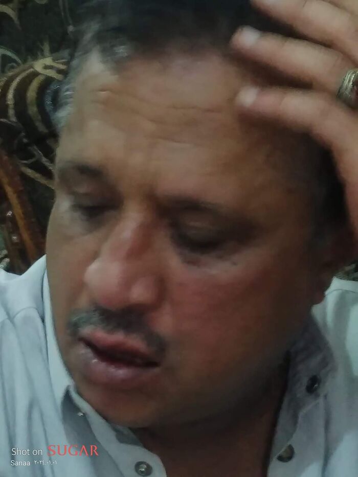 للمرة الثانية.. مسلحون مجهولون يعتدون بالضرب على الصحفي الصمدي