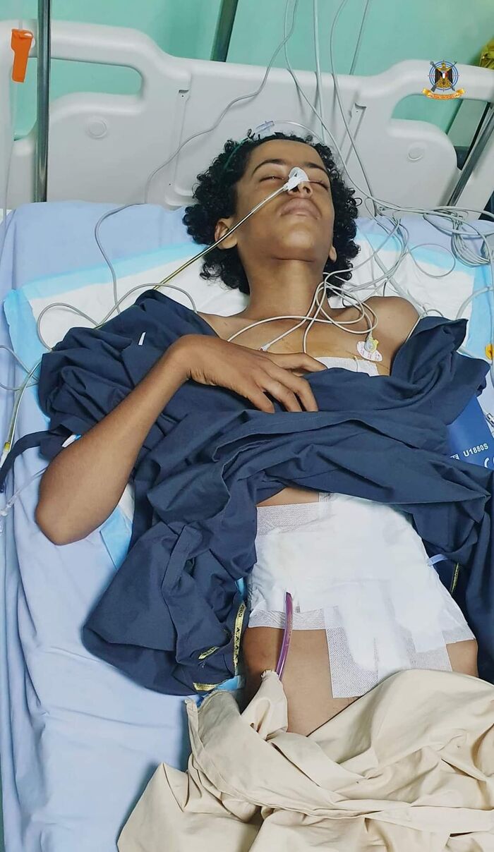 إصابة مدنيين بينهم طفل بقصف حوثي في الضالع