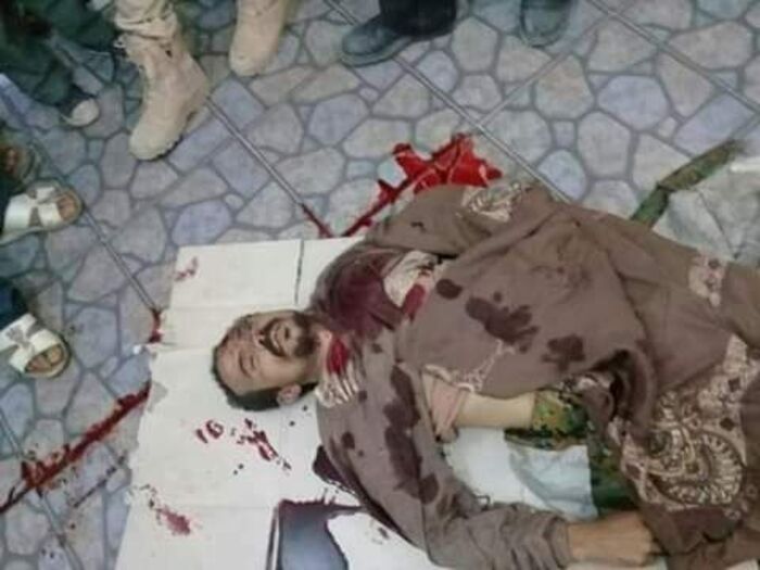 شاهد بالصور : مقتل 57 قرد وأسر 8 من مليشيا الحوثي في ضواحي دمت وفرار جماعي وسط المدينة