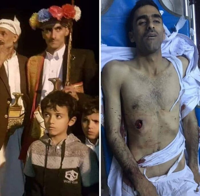 محمد الحوثي.. لن تكون همدان أقوى من القبائل التي وآلتنا ودية مقتول الحطاب "مغرس قات"