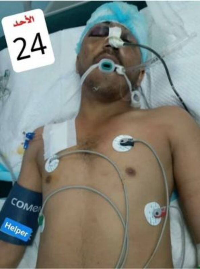 الصيادي يعزي العميد هادي العولقي