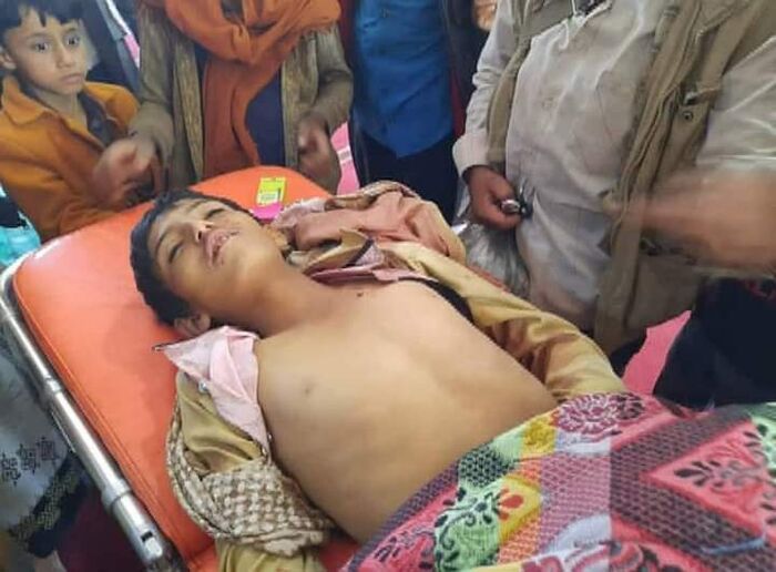 صورة | استشهاد طفل برصاص قناص حوثي في الضالع