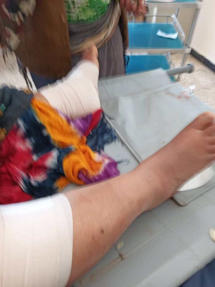 قصف حوثي عشوائي يصيب "مسنّة" ويلحق اضرارا بالمساكن في "حمّان" بالضالع