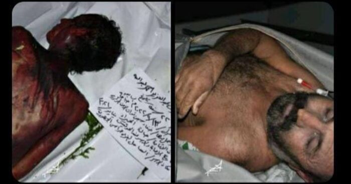 تعذيب وحشي وتصفية أسيرين في سجون مليشيا الحوثي أحدهما من حراس الجمهورية "صورة"