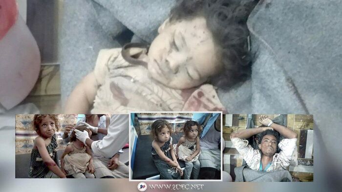 صورة | مجزرة حوثية جديدة بحيس راح ضحيتها 4 شهداء وجرحى معظمهم أطفال