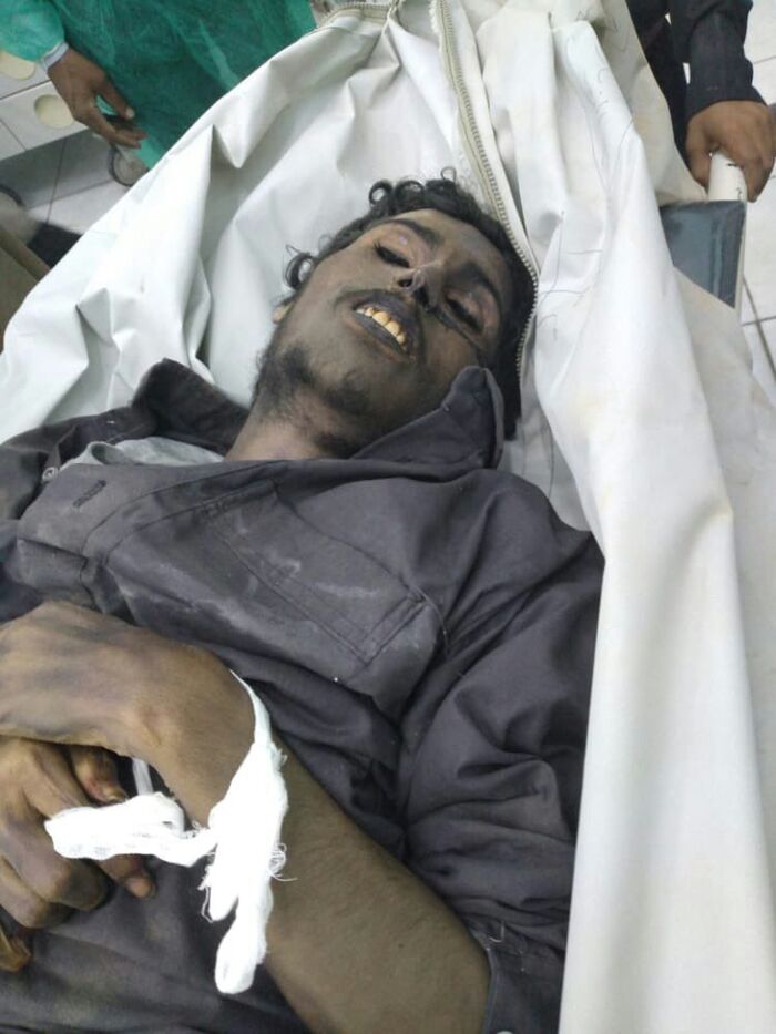 وفاة الاسير الصباري تحت التعذيب في سجون مليشيات الحوثي