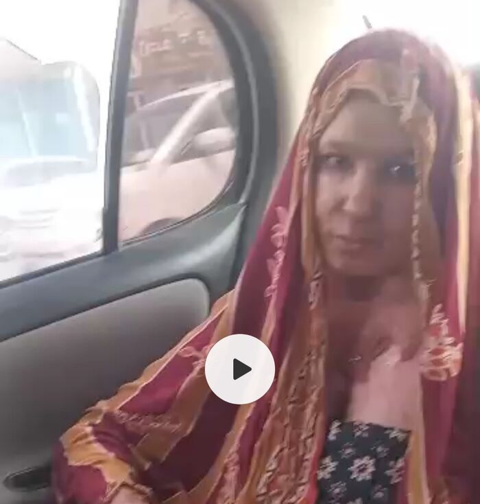 المهرة.. نداء استغاثة امرأة أصيبت بحروق بليغة (فيديو+ وثيقة)