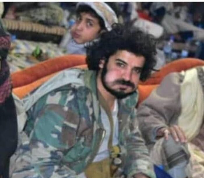 محمد الصباحي يصل عدن مصاباً بعد خوضه مواجهات بطولية مع الحوثيين في رداع