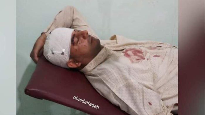 صورة | جرح الزميل #الحدي في جبهات #الضالع
