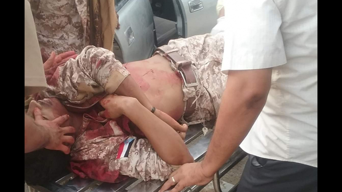 عاجل | اندلاع الاشتباكات في خور مكسر ووصول جرحى الى "الجمهورية" صورة"