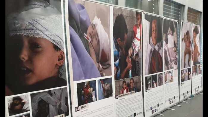 جنيف | صور وحكايات إنسانية تروي جرائم الحوثي في معرض لمؤسسة تمكين