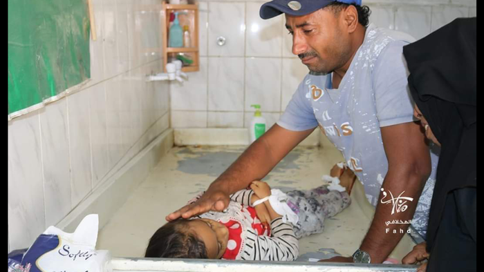 استشهاد طفلة برصاص قناص حوثي غربي تعز