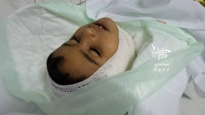 تعز | إستشهاد طفل بقذيفة هاون أطلقتها ميليشيا الحوثي