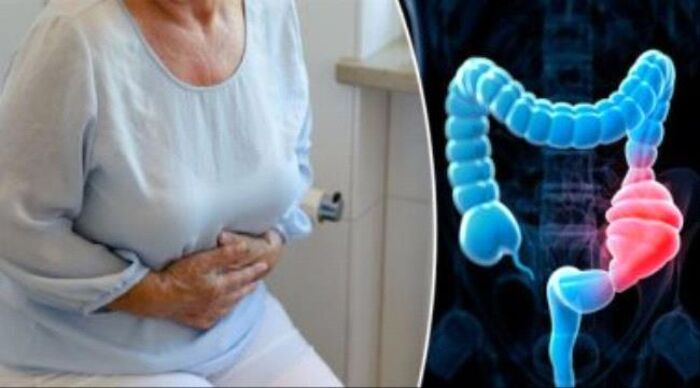 5 طرق طبيعية لعلاج الإمساك