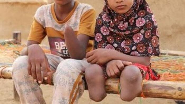 الشبكة اليمنية للحقوق والحريات توثق أكثر من 10 آلاف انتهاك بحق النساء خلال 7 سنوات