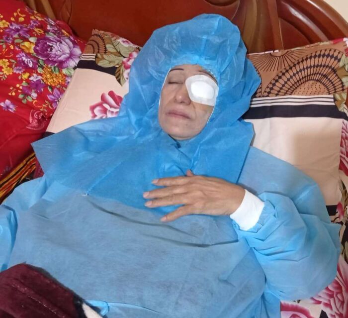 الفنانة اليمنية أمل كعدل تجري عملية سحب المياه البيضاء