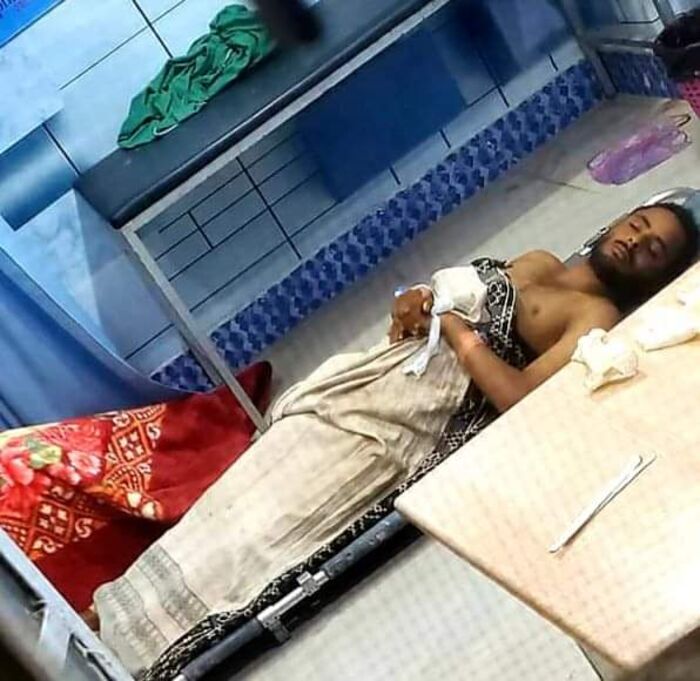 مقتل بائع متجول برصاص مليشيا الحوثي في دمت
