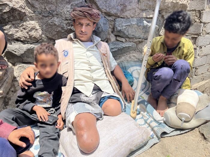 بعثة أممية تعلن مقتل 8 مدنيين بينهم طفلان بانفجار ألغام في الحديدة خلال مارس