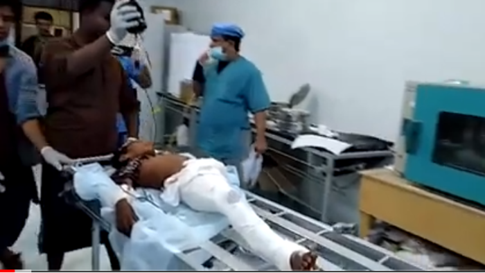 فيديو: مدير شرطة الحديدة يزور جرحى جريمة القصف الحوثي على حيس